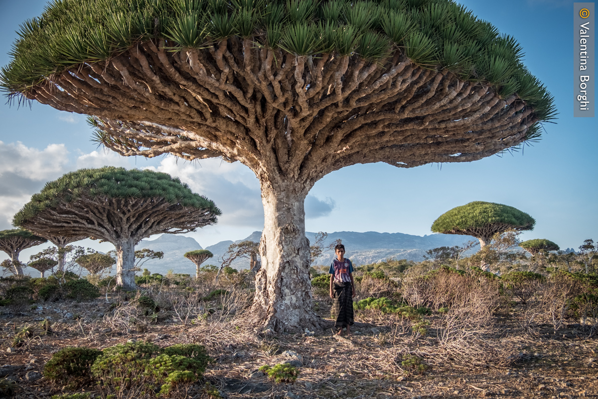 bambino sotto ad un albero di drago a Socotra, Yemen